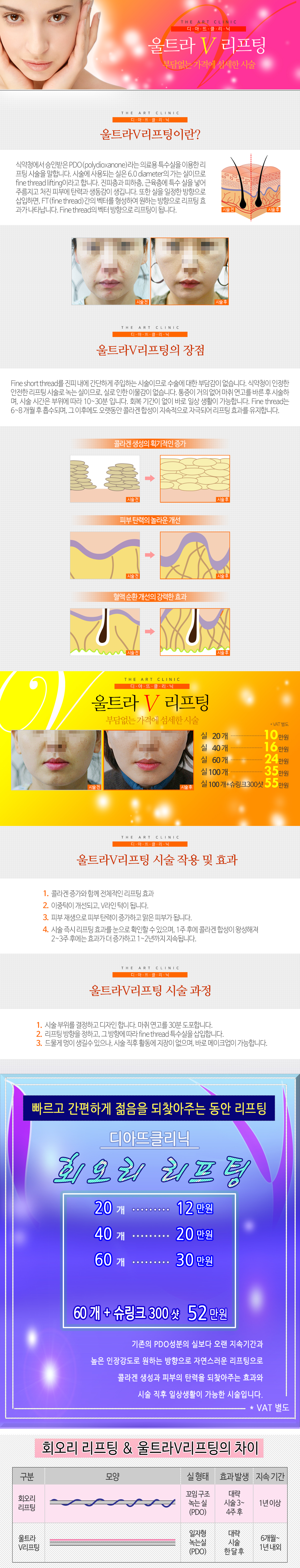 울트라V · 회오리 대표 이미지 1